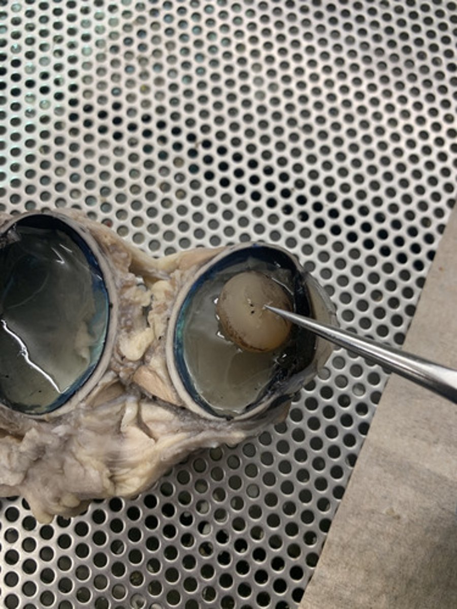 <p>the transparent structure behind the pupil that changes shape to help focus images on the retina</p>