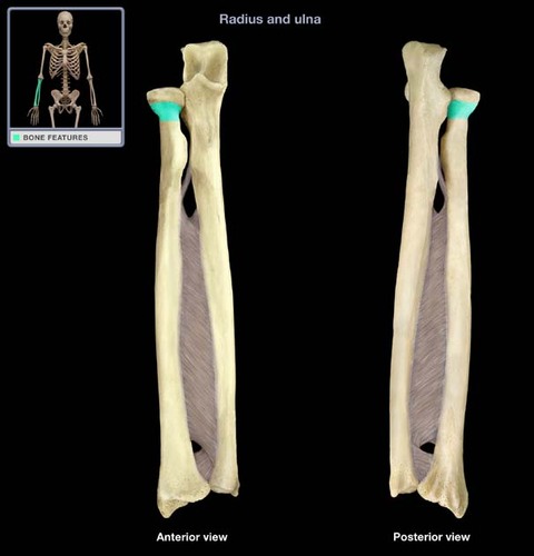 <p>between head and radial tuberosity</p>