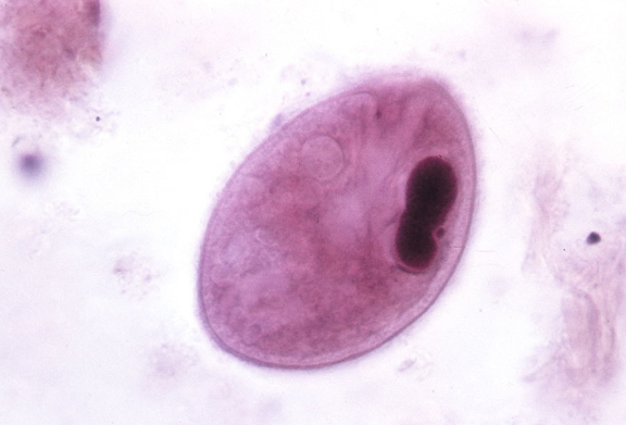 <p>Identify the organism and stage</p>