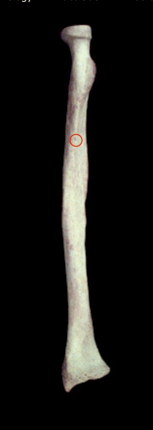 <p>What structure is this?</p>