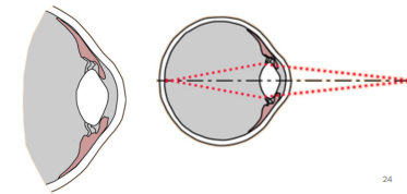 <p>Viewing nearby objects:</p>