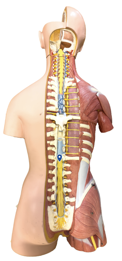 <p>What cone-shaped structure of the spinal cord is the arrow pointing to?</p>