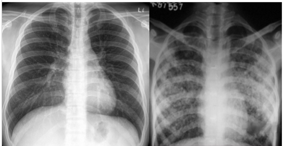 <p>whats the dx?</p>