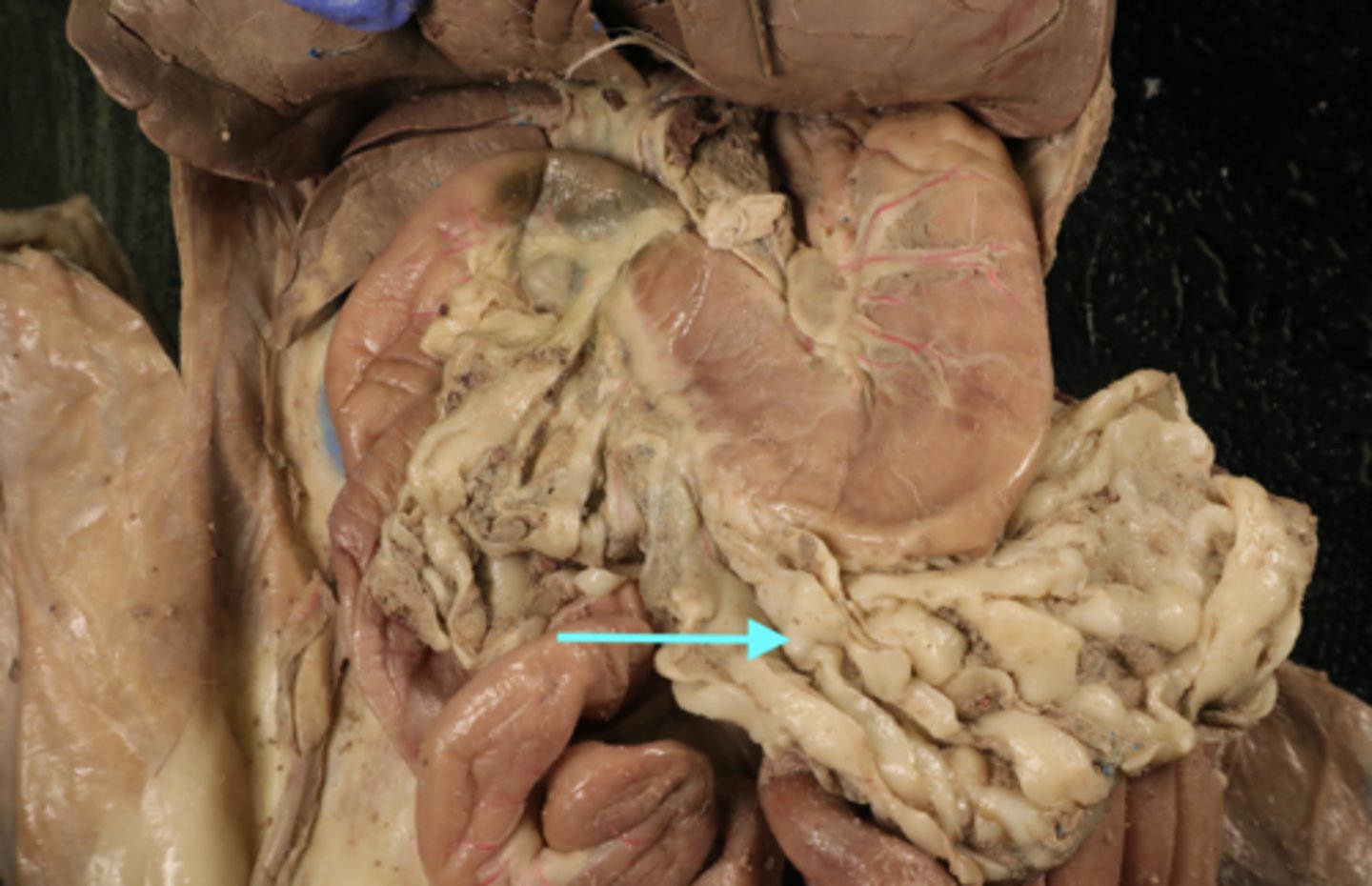 <p>What is this?</p>