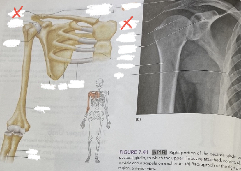 flat part of scapula that meets clavicle