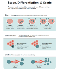 <p>extent to which neoplastic cells resemble normal cells</p><ul><li><p>well</p></li><li><p>moderately</p></li><li><p>poorly</p></li></ul><p></p>