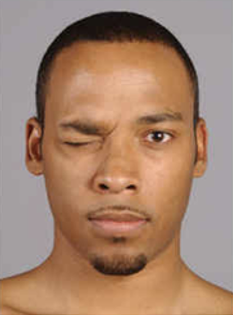 <p>is a circular muscle around the eye that allows for the closing of the eyelids and helps in movements like squinting or blinking. </p>