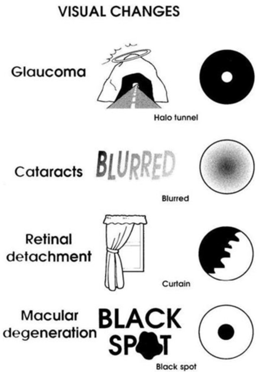 <p>pupil smaller, increase density of lens, diminished tear production, loss of receptors, decrease in muscle tone</p>