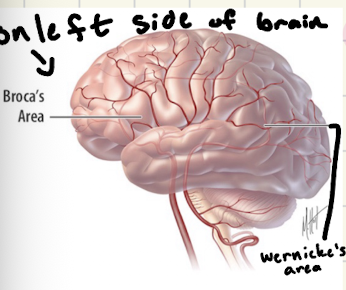 <p>responsible for speech comprehension → located by parietal area → everything is just word salad</p>