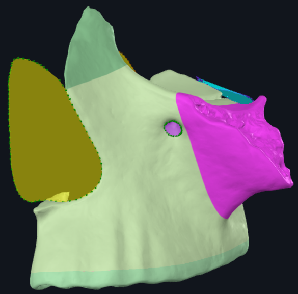 term image