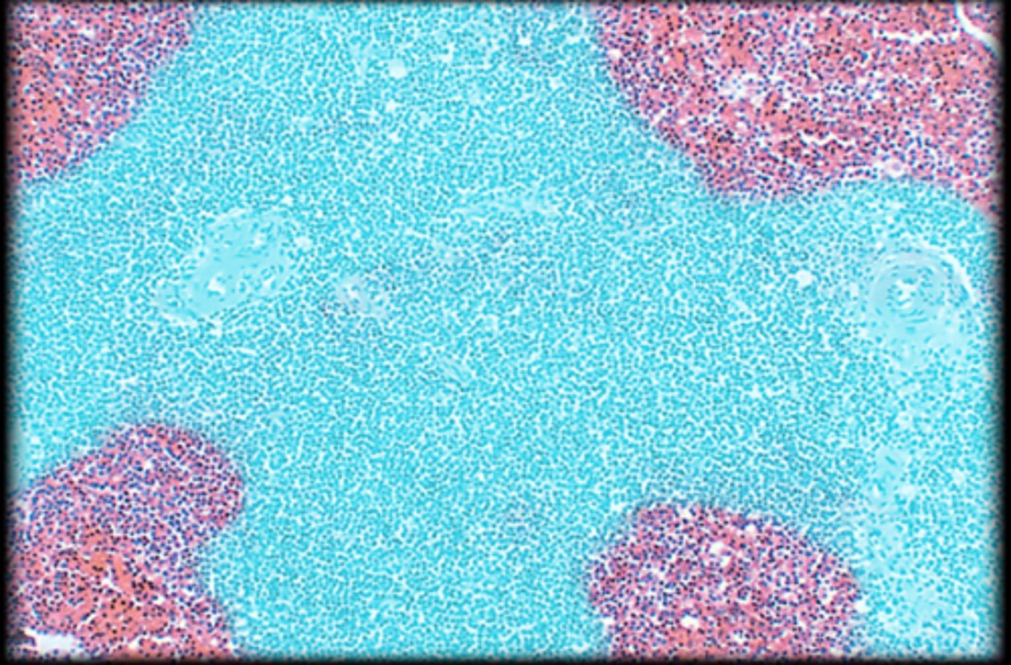 <p>Spleen</p>