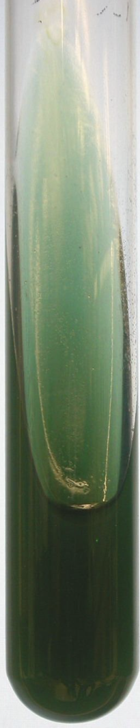 <p>Is this a positive or negative Simmon’s citrate agar?</p>