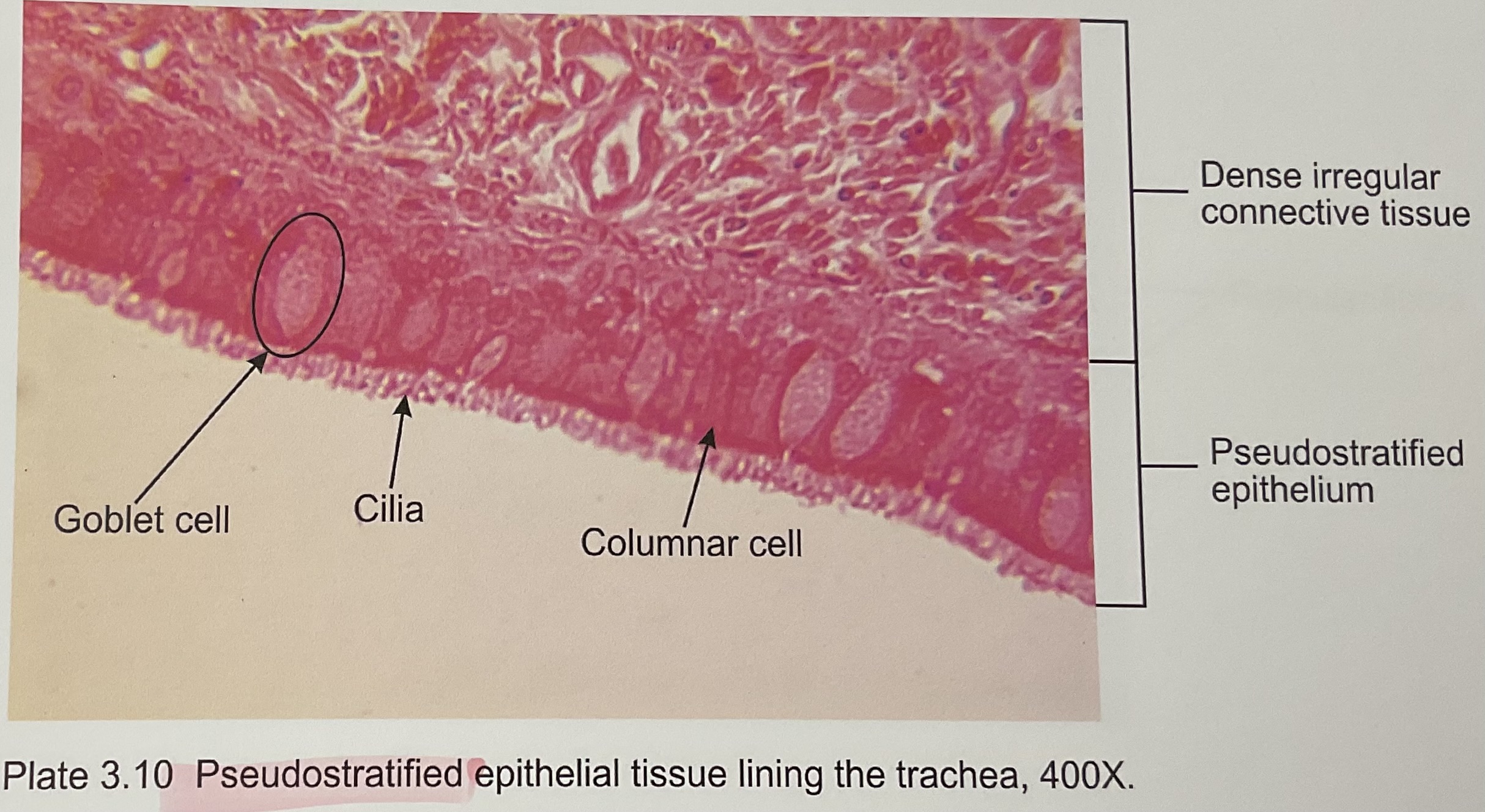 <p>Pseudostratified </p>