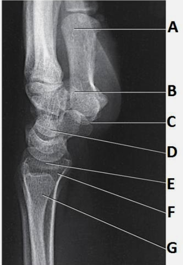 <p>In this Lateral Wrist projection, what is indicated by label D?</p>