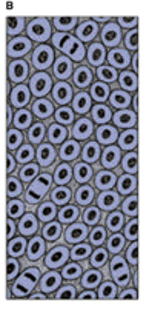 <p>Mitotic proliferation of mesenchymal cells gives rise to a highly cellular tissue</p>