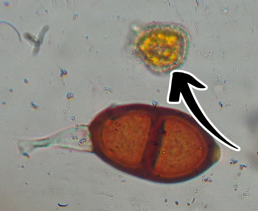 <p>Puccinia graminis: Vad är detta för spor?</p>