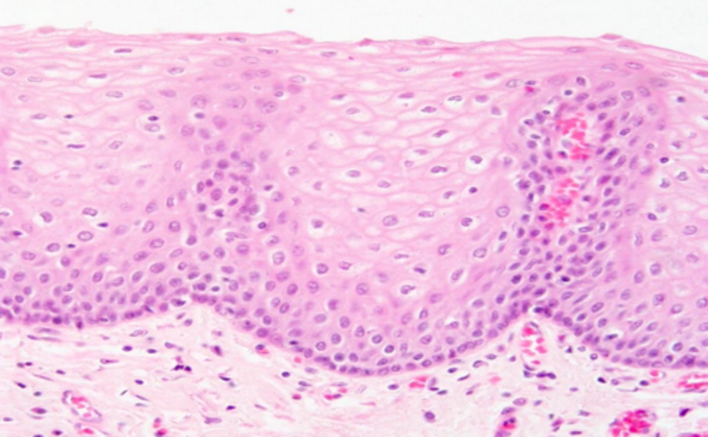 <p>is this epithelium keratinized or non-keratinized?</p>