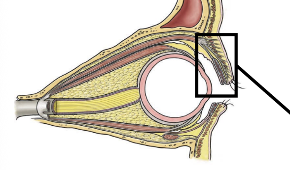 <ul><li><p>dense connective tissue core</p></li><li><p>skin on external surfaces</p></li><li><p>conjunctiva on inner surface</p></li><li><p>protect and spread tears</p></li></ul><p></p>