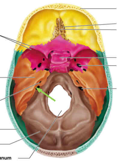 <p>What cranial nerve is indicated?</p>