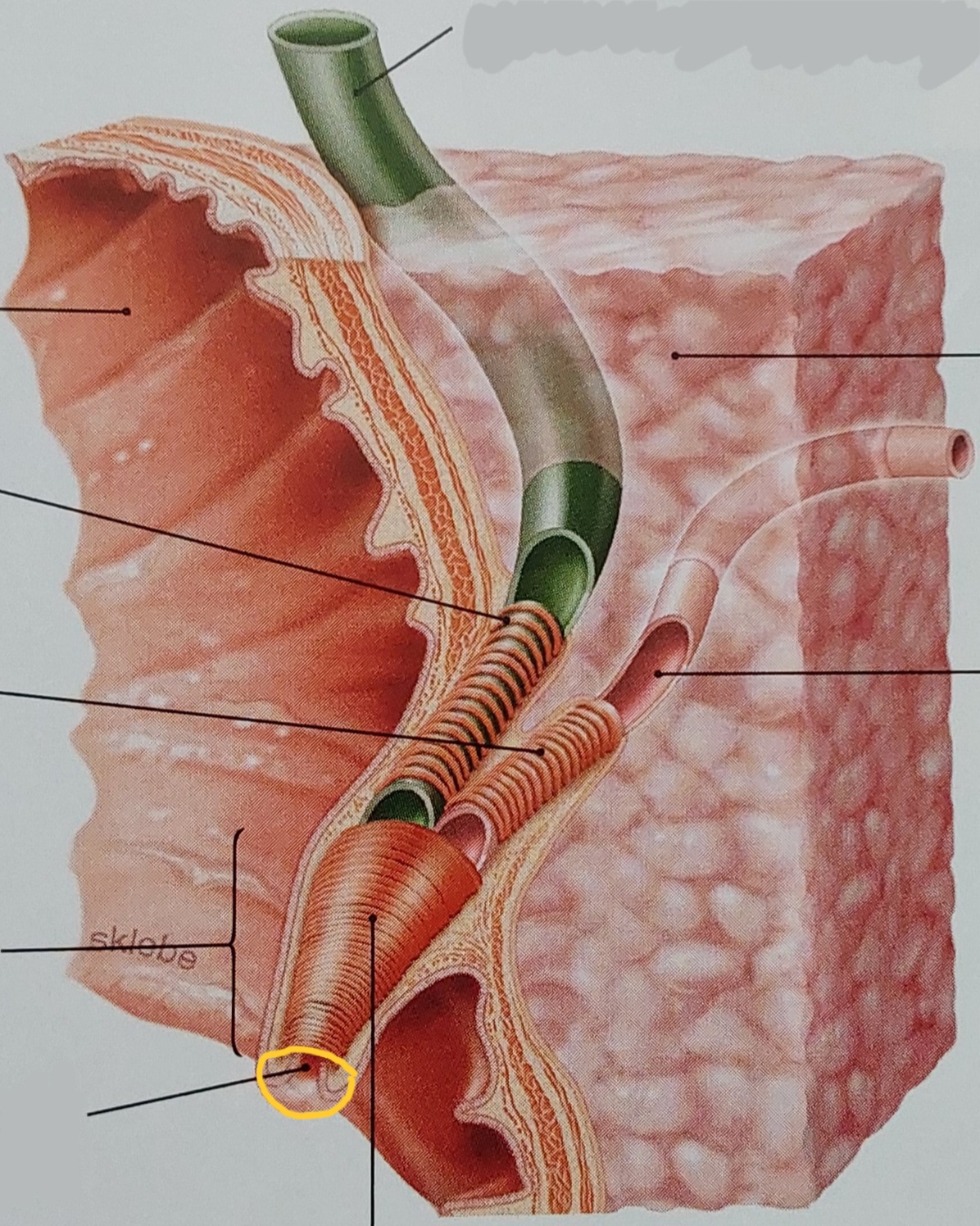 term image