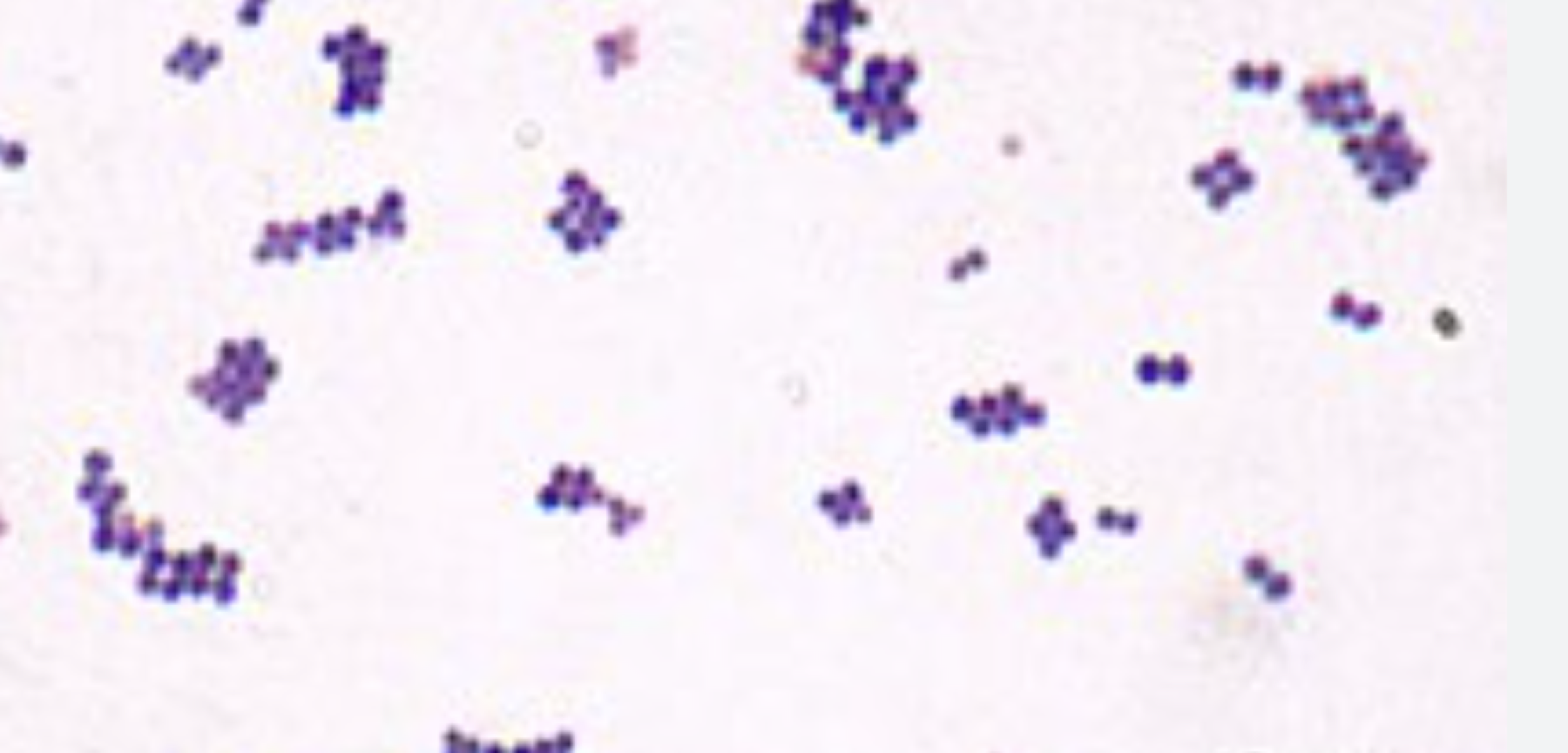 <p><span style="color: rgb(246, 246, 246);"><span>S. aureus or E. coli</span></span></p>