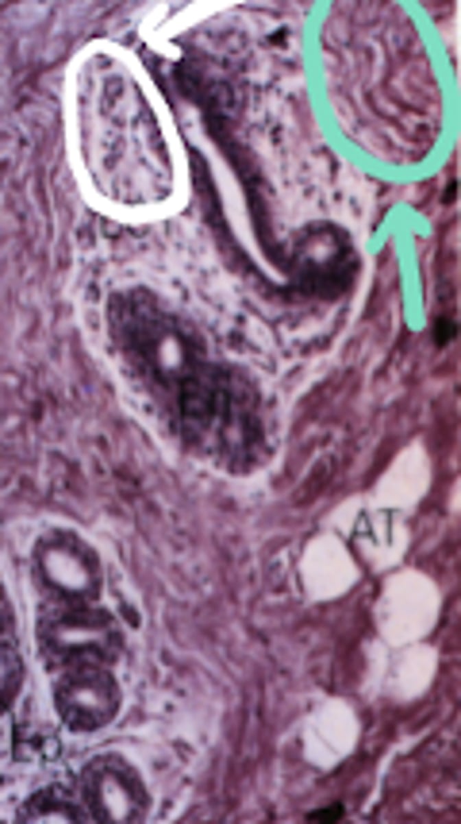 <p>What is the type of tissue circled in green?</p>