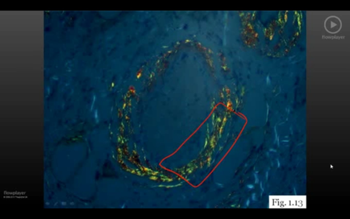 <p>same slide as before placed under polarized light showing what</p>
