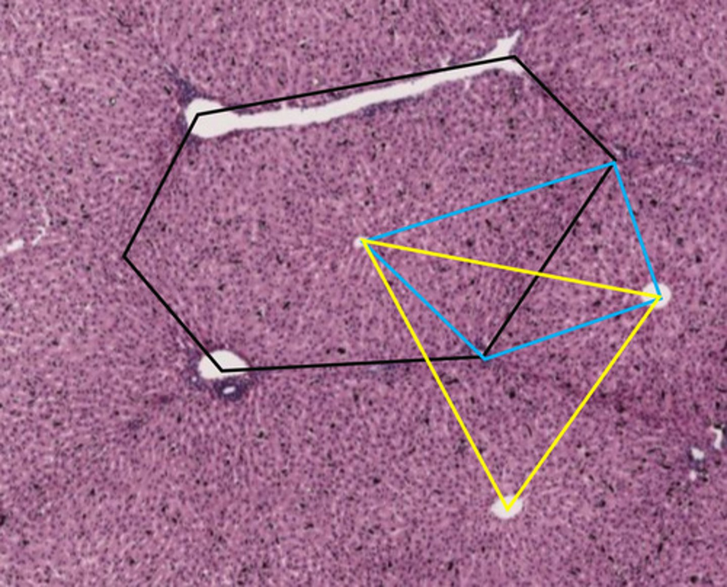 <p>black hexagon</p>