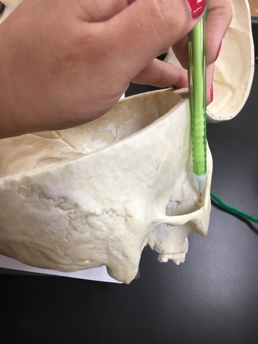 transmits namesake nerve