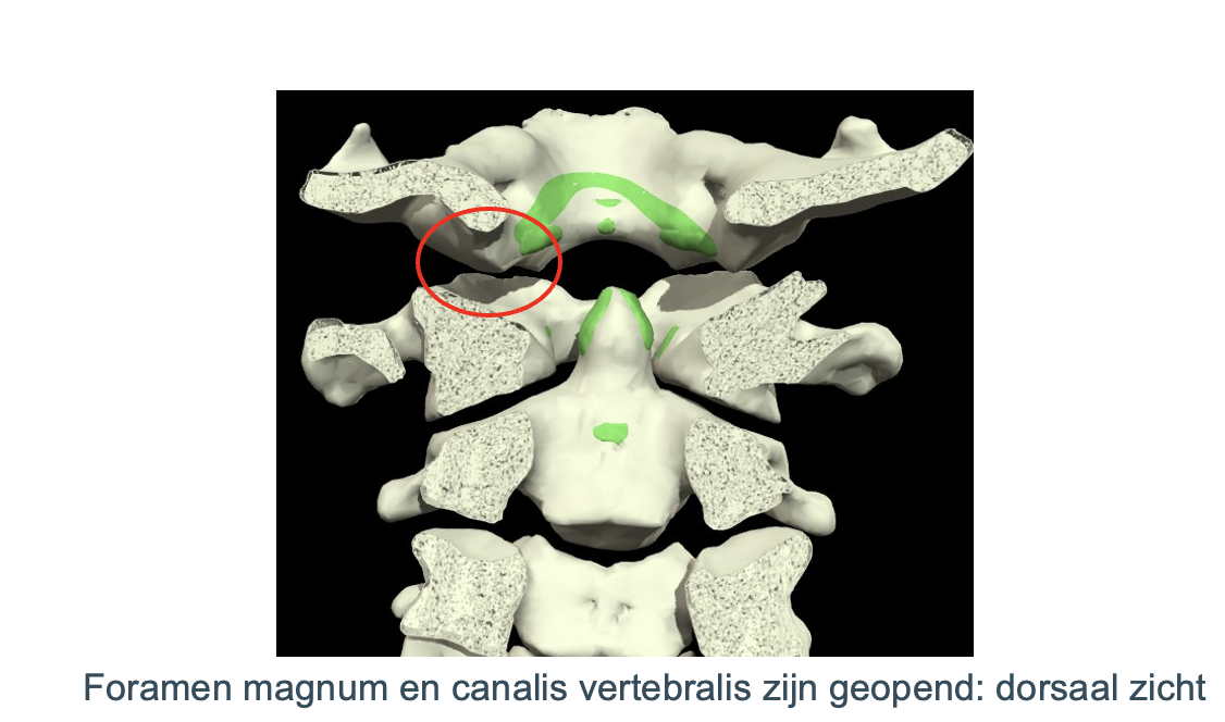 <p>Welk gewricht?</p>