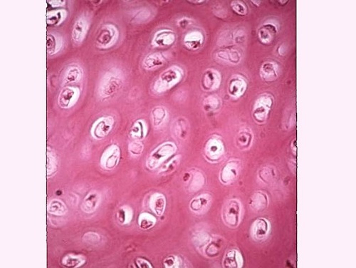 <p>Chondrocytes. cartilage in the ribs, nose. Smooth tissue. In articular surfaces -&gt; joints</p>