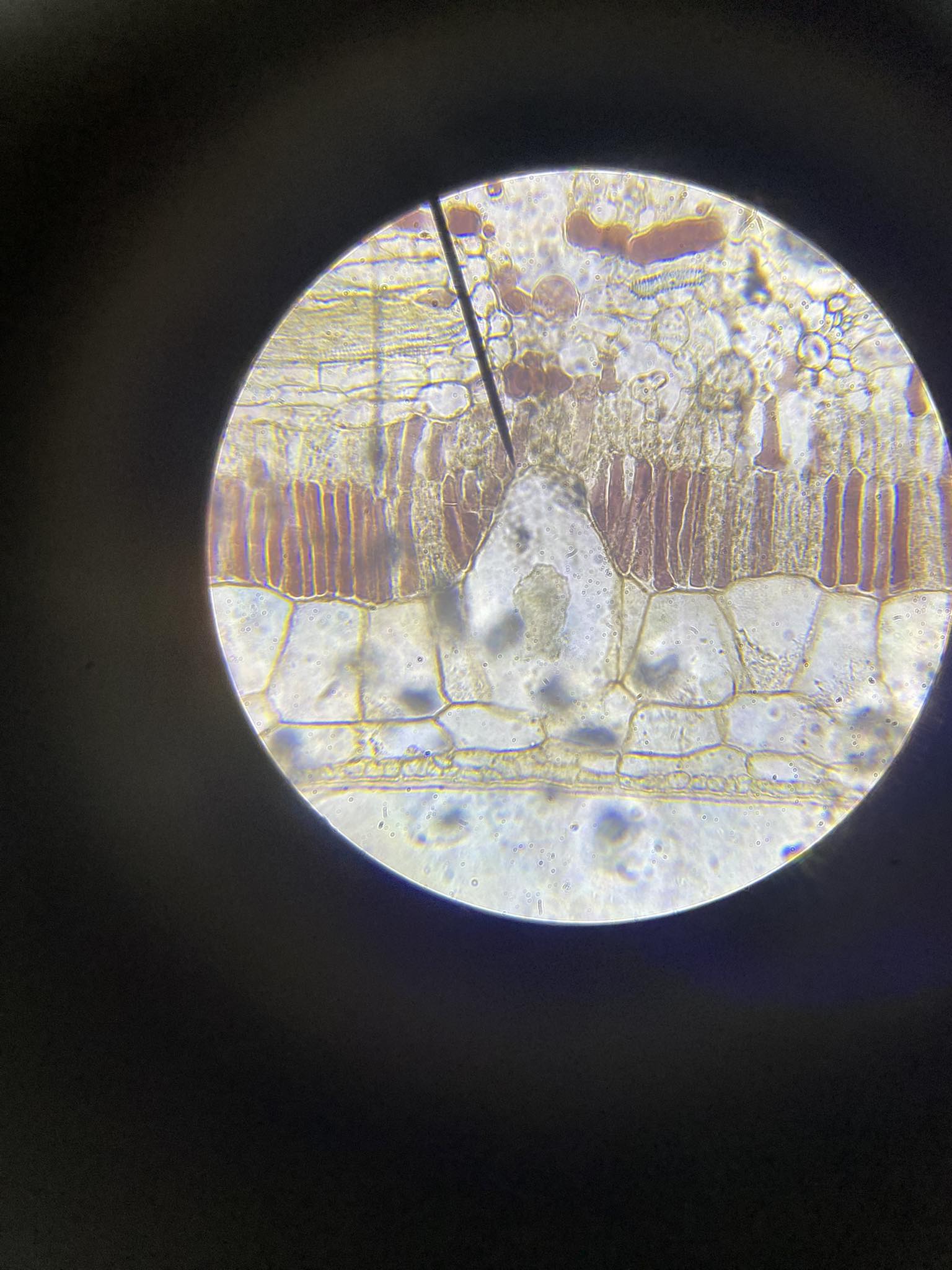 <p>What plant crystals are shown below?</p>