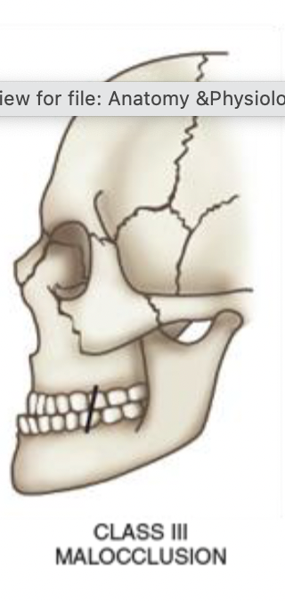 <ul><li><p>relatively protruded mandible</p></li></ul><p></p>