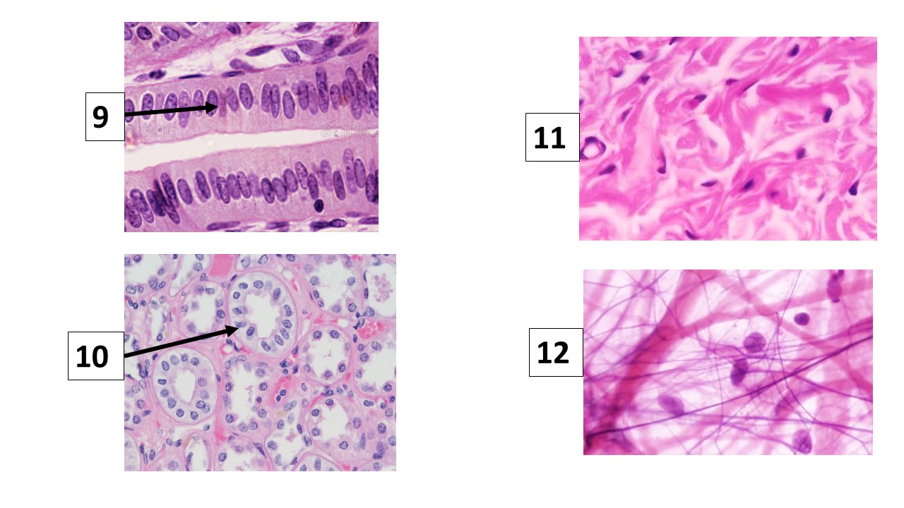 <p>Identify tissue #9</p>