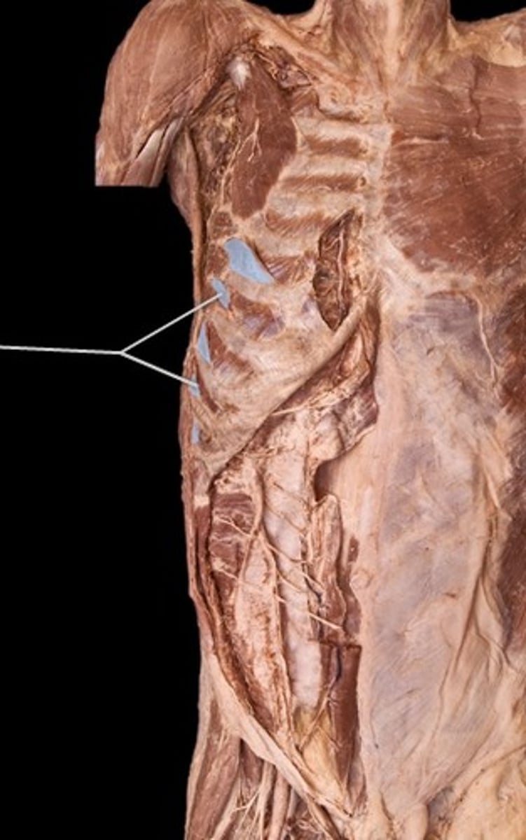 <p>What muscle is this?</p>