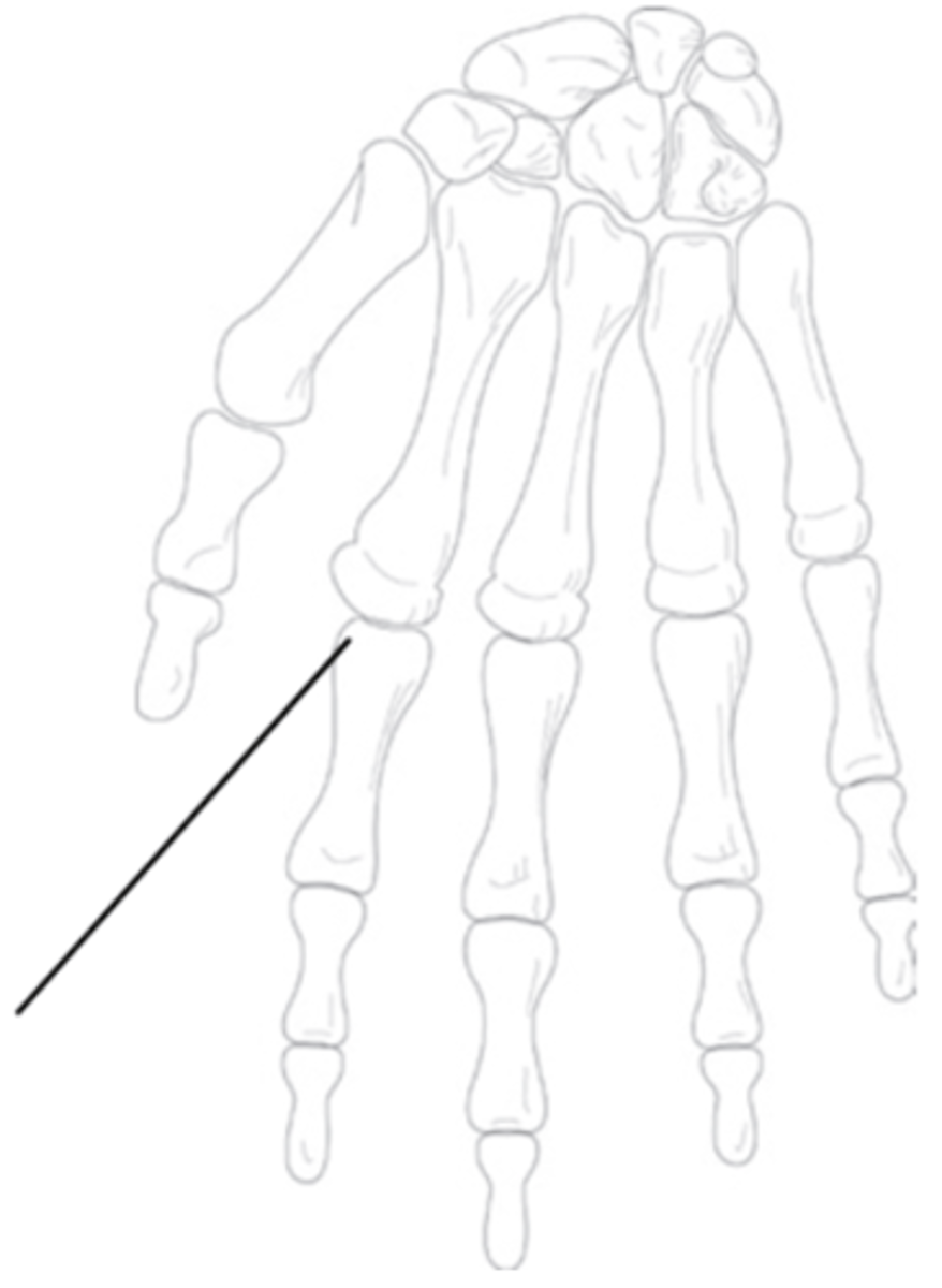 <p>What is the name of this joint based off of the shape of the articulating bones?</p>