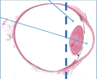 <p>Anterior segment</p>