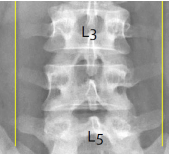 <p>Q what is the name of this measurement? and what is the average + range?</p>