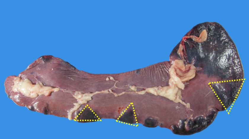 <p>Which diagnosis is most consistent with the gross lesion? </p>