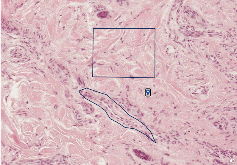 <p>identify area of histological slide, type of CT, and identify structures</p>