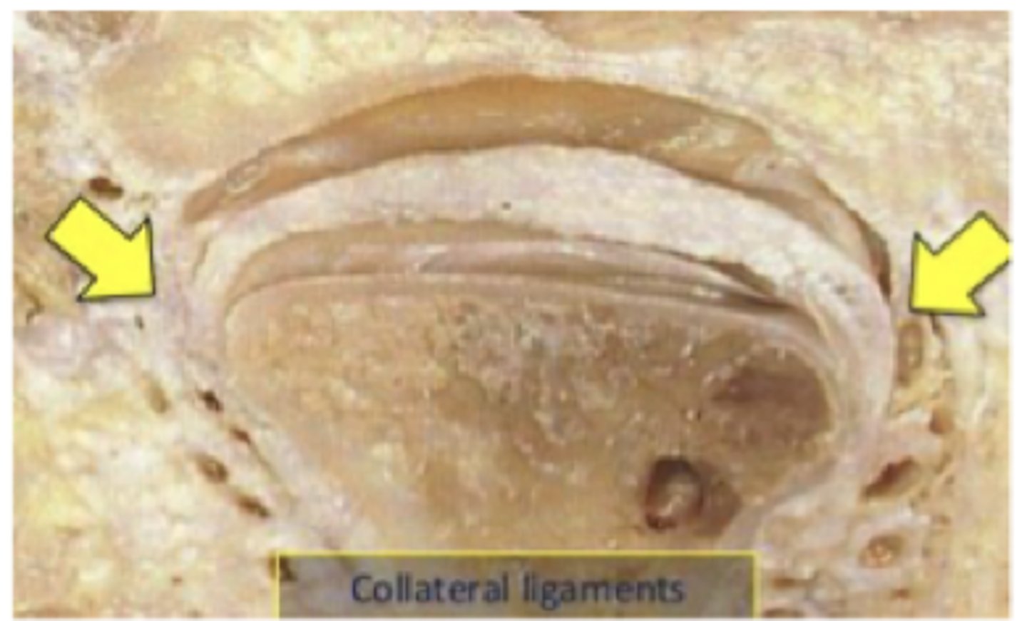 <p>- Fixerar disken till kondylen, så att disken inte släpper kondylen vid rörelse</p><p>- Delar leden i 2 hålrum</p><p>- Tillåter disken att rotera anteriort och posteriort på kondylen</p>