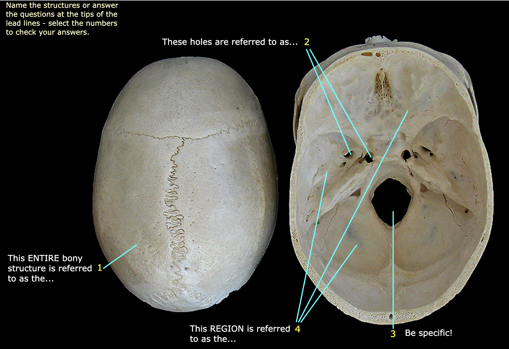 What structure is labeled 3?