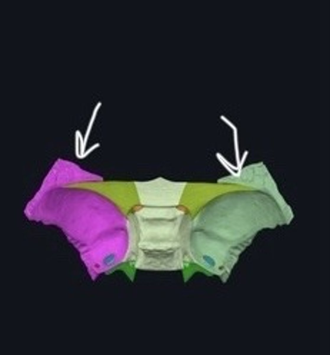 <p>Part of the sphenoid bone extending laterally.</p>
