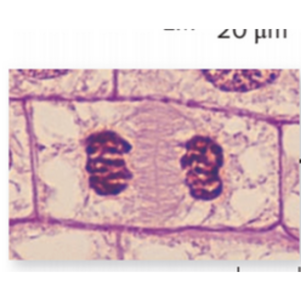 <p>What kind of cell is shown? Name the phase that it is experiencing.</p>