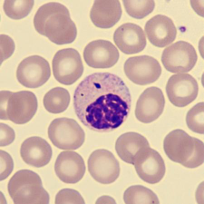 <p>What is this neutrophil showing?</p>