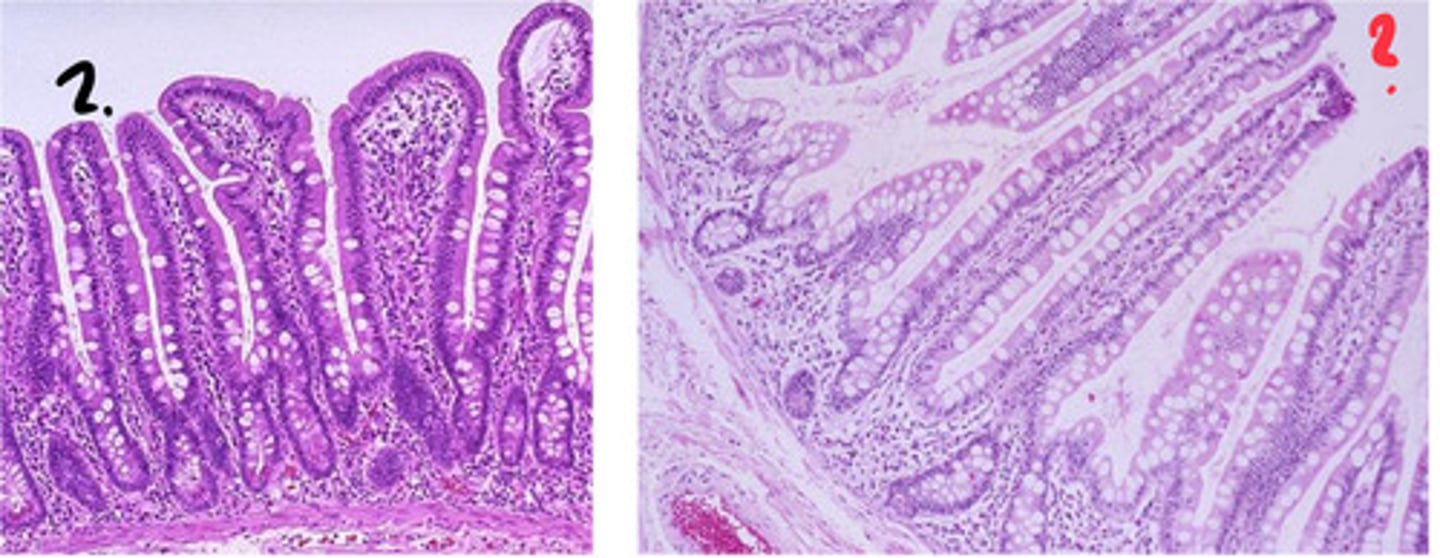 <p>which of these is the duodenum? which is the ileum? how can you tell?</p>