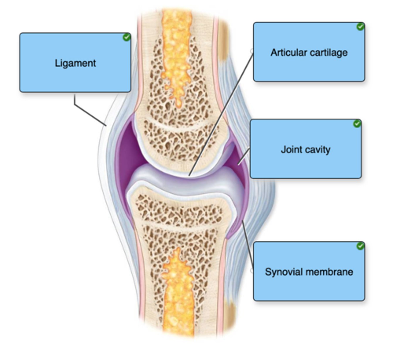 <p>Left: Ligament</p><p>Right, top to bottom:</p><p>Articular cartilage</p><p>Joint cavity</p><p>Synovial membrane</p>