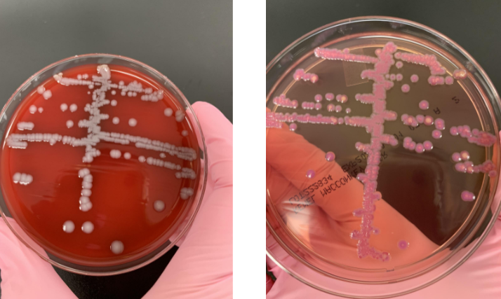 <p>lets say your API strip showed indole (-), citrate (+) and urease (+), what organism would it be</p>