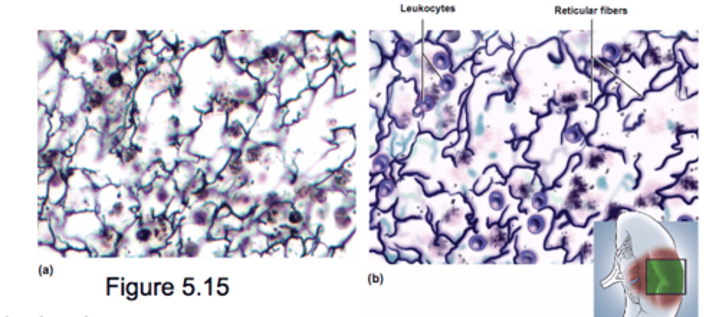 <p>Loose network of reticular fiber and cells</p><p>Forms supportive framework (stroma) for lymphatic organs</p><p>- lymph nodes</p><p>- spleen</p>