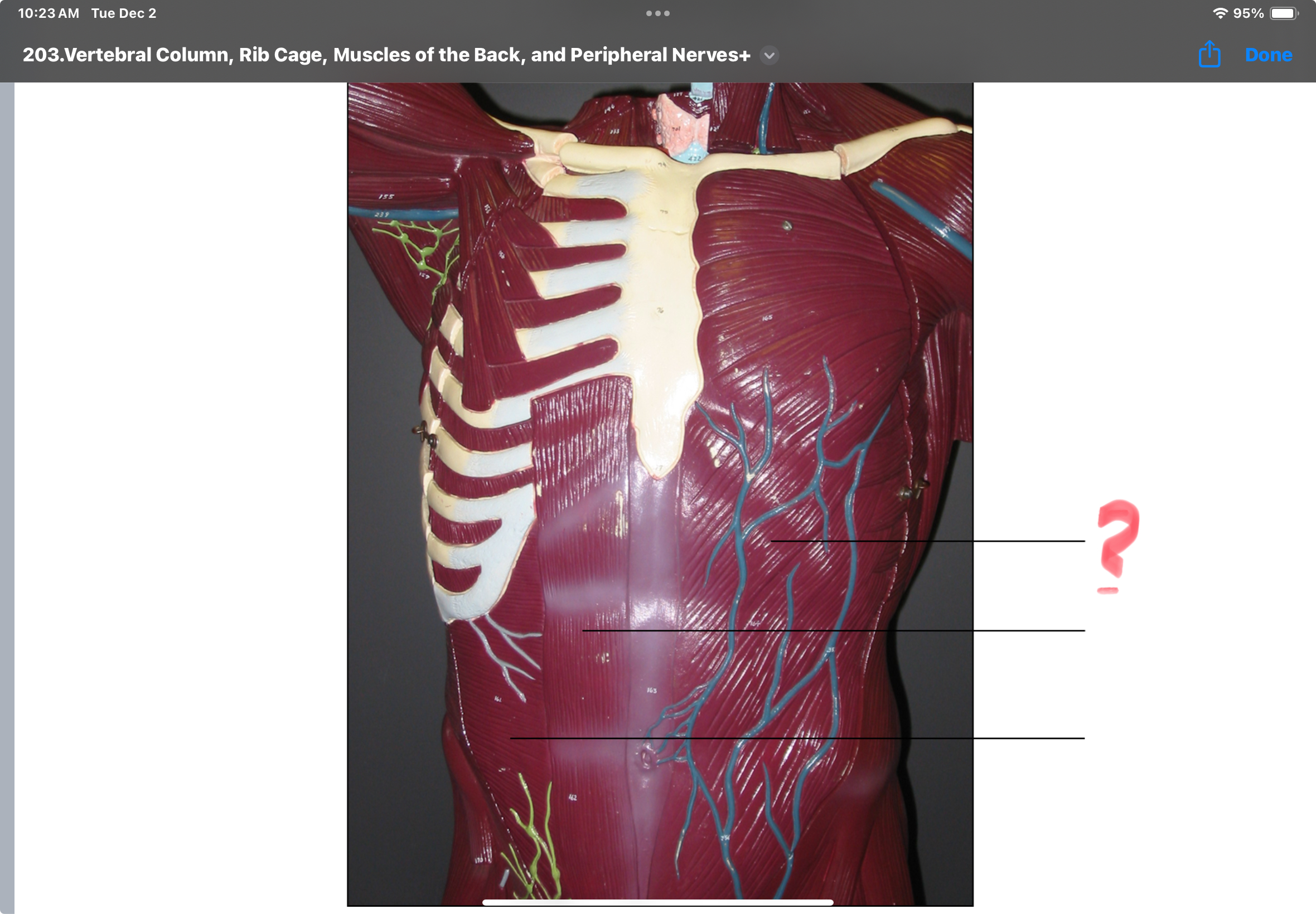 <p>Internal oblique Action:Flex and rotate vertebral column; compresses abdomen</p>